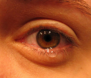 eye